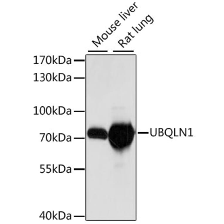 Western Blot - Anti-Ubiquilin/UBQLN1 Antibody (A90997) - Antibodies.com