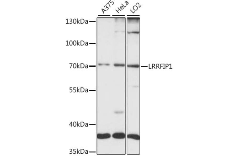 Western Blot - Anti-LRRFIP1 Antibody (A15752) - Antibodies.com