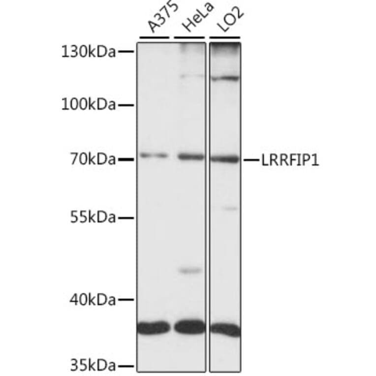Western Blot - Anti-LRRFIP1 Antibody (A15752) - Antibodies.com