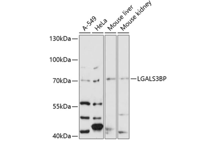 Western Blot - Anti-LGALS3BP Antibody (A12005) - Antibodies.com