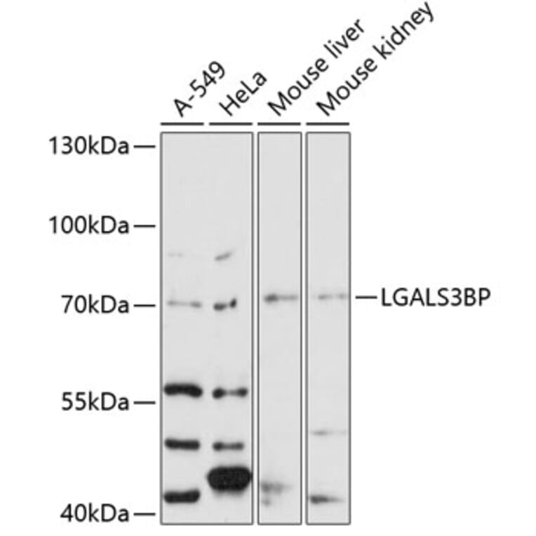 Western Blot - Anti-LGALS3BP Antibody (A12005) - Antibodies.com