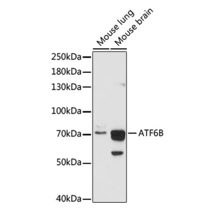 Western Blot - Anti-ATF6B Antibody (A91000) - Antibodies.com