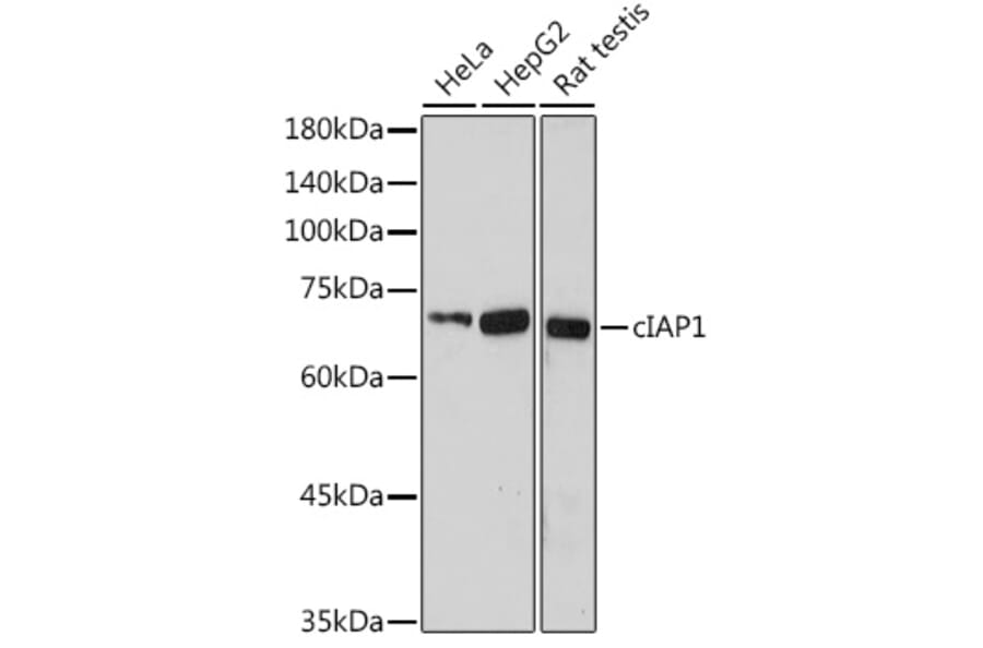 Western Blot - Anti-cIAP1 Antibody (A91001) - Antibodies.com