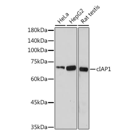 Western Blot - Anti-cIAP1 Antibody (A91001) - Antibodies.com