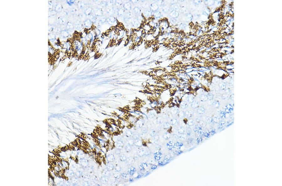 Immunohistochemistry - Anti-cIAP1 Antibody (A91001) - Antibodies.com