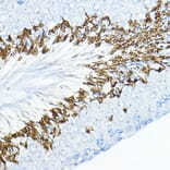 Immunohistochemistry - Anti-cIAP1 Antibody (A91001) - Antibodies.com