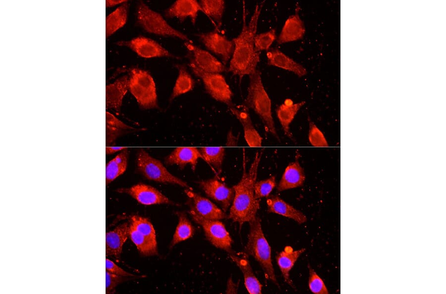Immunofluorescence - Anti-cIAP1 Antibody (A91001) - Antibodies.com