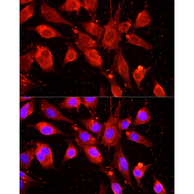 Immunofluorescence - Anti-cIAP1 Antibody (A91001) - Antibodies.com