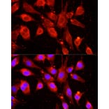 Immunofluorescence - Anti-cIAP1 Antibody (A91001) - Antibodies.com