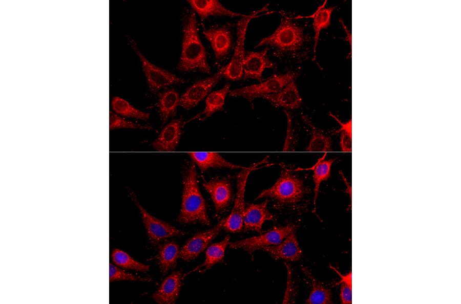 Immunofluorescence - Anti-cIAP1 Antibody (A91001) - Antibodies.com