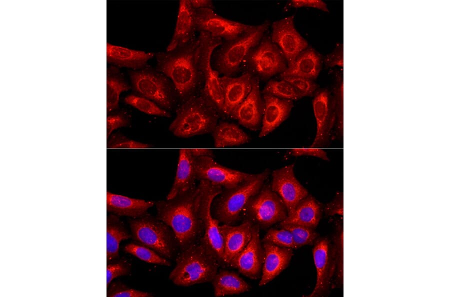 Immunofluorescence - Anti-cIAP1 Antibody (A91001) - Antibodies.com