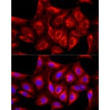 Immunofluorescence - Anti-cIAP1 Antibody (A91001) - Antibodies.com