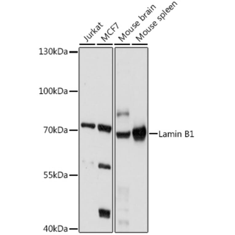 Western Blot - Anti-Lamin B1 Antibody (A91002) - Antibodies.com