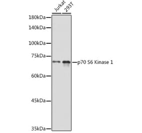 Western Blot - Anti-S6K1 Antibody (A91003) - Antibodies.com