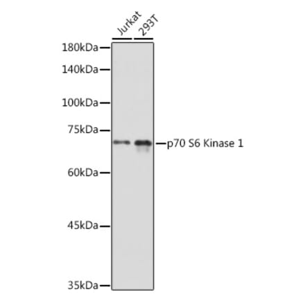 Western Blot - Anti-S6K1 Antibody (A91003) - Antibodies.com