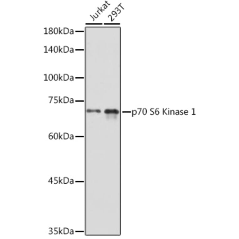 Western Blot - Anti-S6K1 Antibody (A91003) - Antibodies.com
