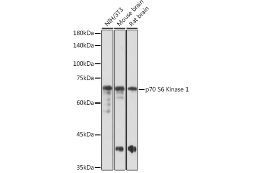 Western Blot - Anti-S6K1 Antibody (A91003) - Antibodies.com