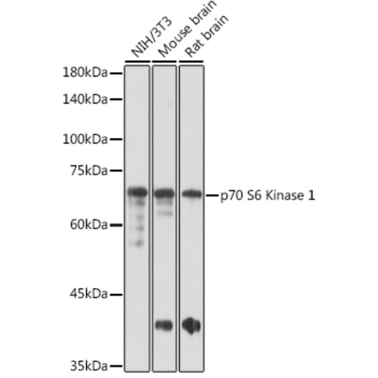 Western Blot - Anti-S6K1 Antibody (A91003) - Antibodies.com