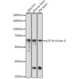 Western Blot - Anti-S6K1 Antibody (A91003) - Antibodies.com