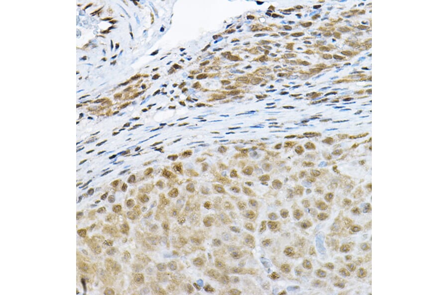 Immunohistochemistry - Anti-S6K1 Antibody (A91003) - Antibodies.com