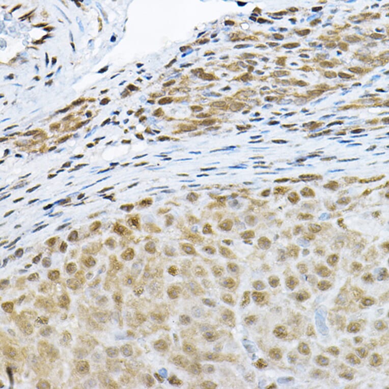 Immunohistochemistry - Anti-S6K1 Antibody (A91003) - Antibodies.com