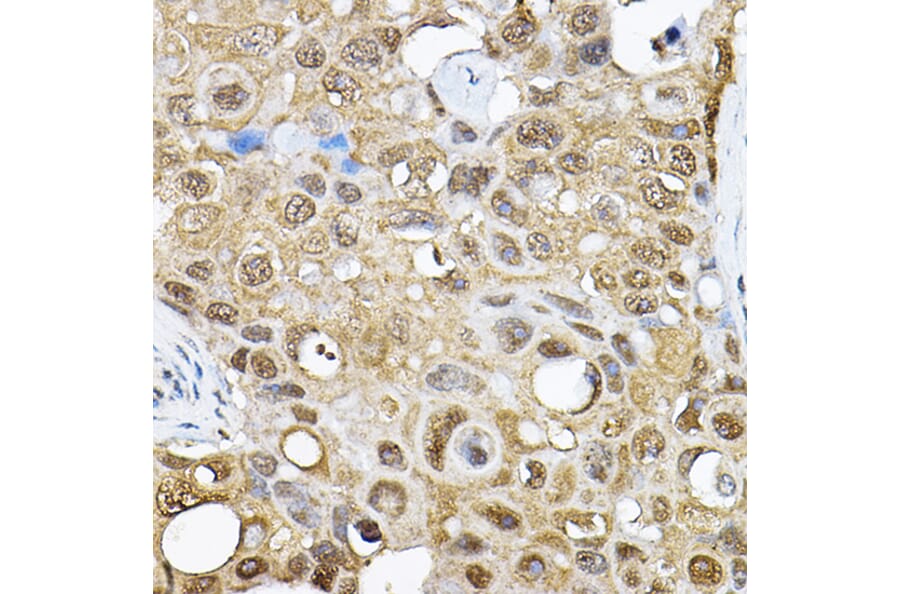 Immunohistochemistry - Anti-S6K1 Antibody (A91003) - Antibodies.com