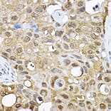 Immunohistochemistry - Anti-S6K1 Antibody (A91003) - Antibodies.com