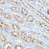 Immunohistochemistry - Anti-S6K1 Antibody (A91003) - Antibodies.com