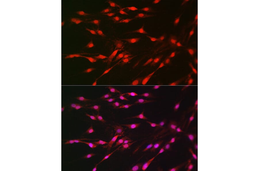 Immunofluorescence - Anti-S6K1 Antibody (A91003) - Antibodies.com