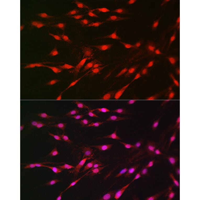 Immunofluorescence - Anti-S6K1 Antibody (A91003) - Antibodies.com