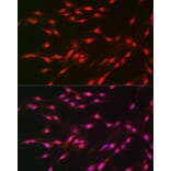 Immunofluorescence - Anti-S6K1 Antibody (A91003) - Antibodies.com