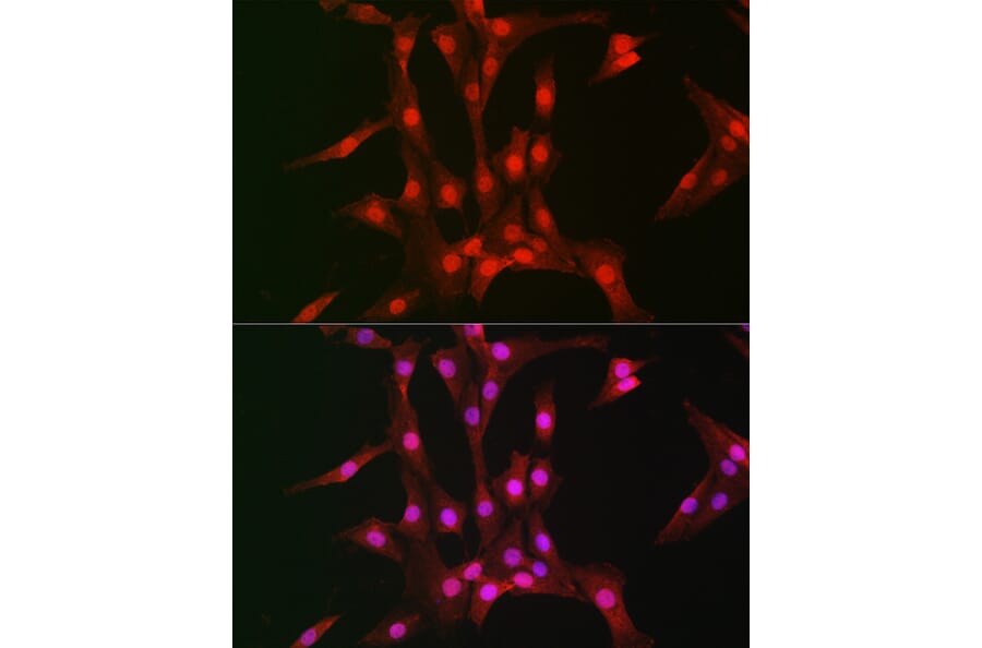Immunofluorescence - Anti-S6K1 Antibody (A91003) - Antibodies.com
