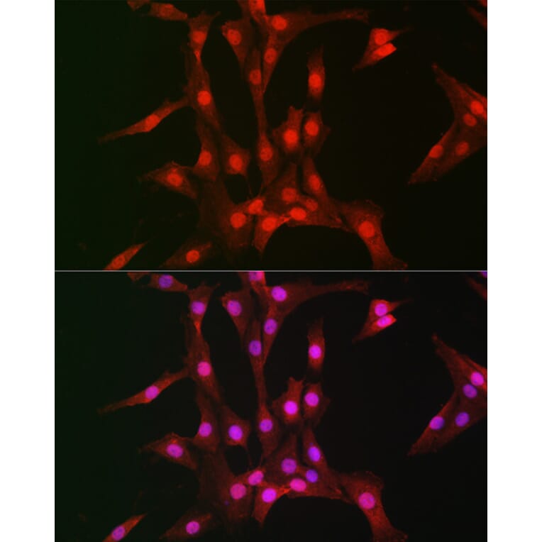Immunofluorescence - Anti-S6K1 Antibody (A91003) - Antibodies.com