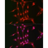 Immunofluorescence - Anti-S6K1 Antibody (A91003) - Antibodies.com