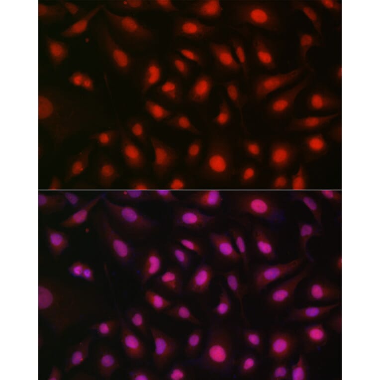 Immunofluorescence - Anti-S6K1 Antibody (A91003) - Antibodies.com