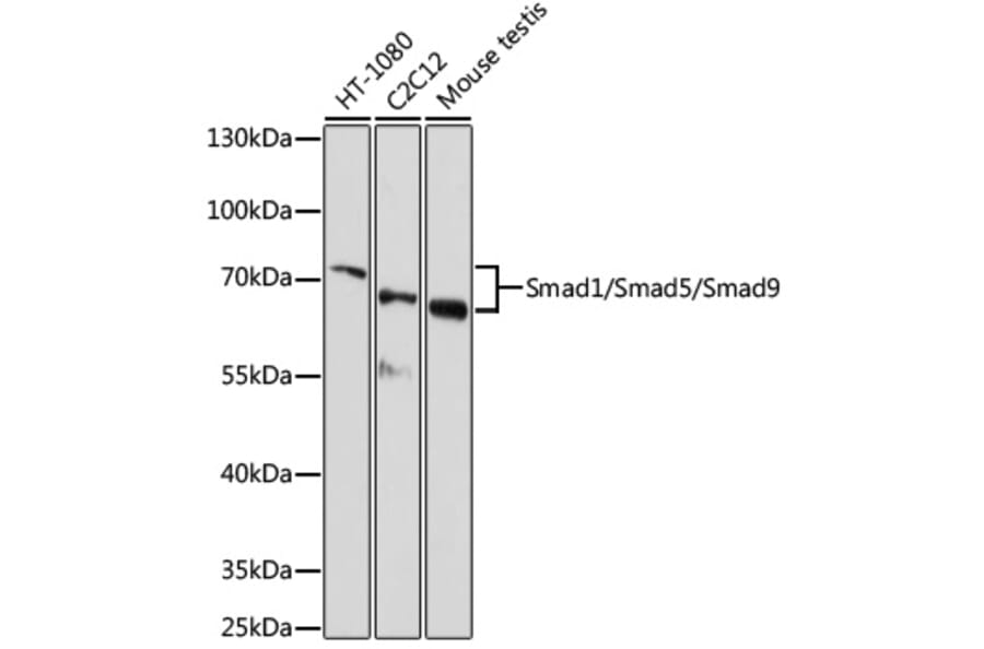 Western Blot - Anti-SMAD1 + SMAD5 + SMAD9 Antibody (A17439) - Antibodies.com