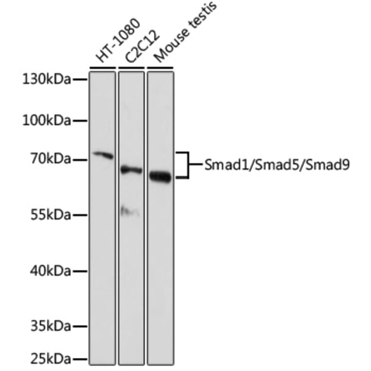 Western Blot - Anti-SMAD1 + SMAD5 + SMAD9 Antibody (A17439) - Antibodies.com