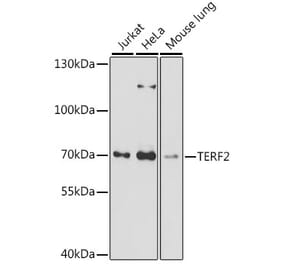 Western Blot - Anti-TRF2 Antibody (A91005) - Antibodies.com