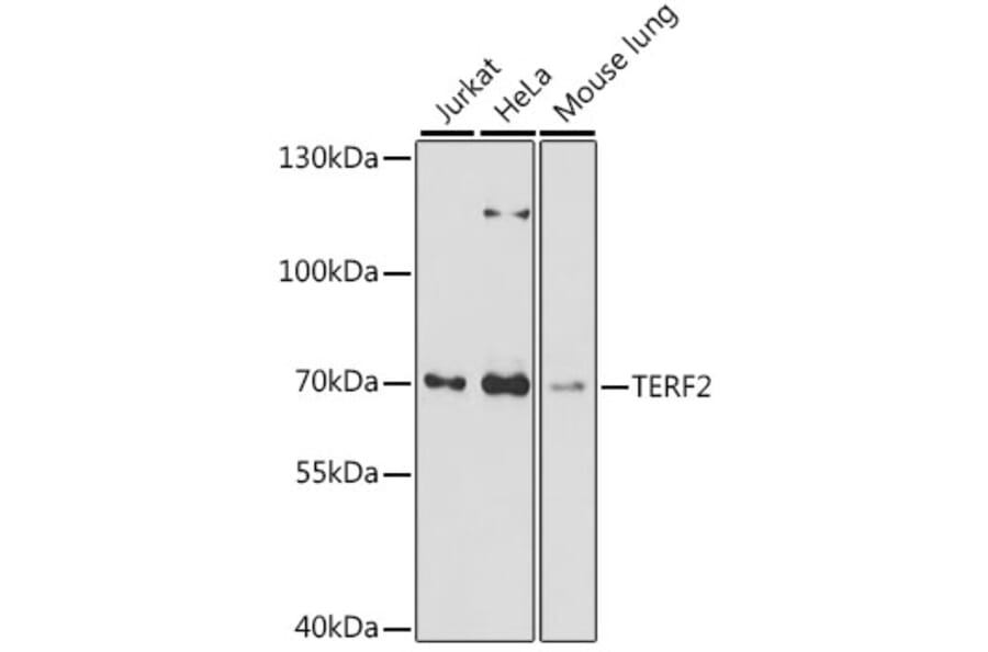 Western Blot - Anti-TRF2 Antibody (A91005) - Antibodies.com