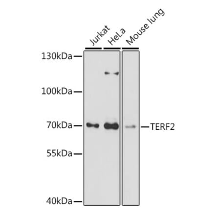 Western Blot - Anti-TRF2 Antibody (A91005) - Antibodies.com
