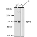 Western Blot - Anti-TRF2 Antibody (A91005) - Antibodies.com