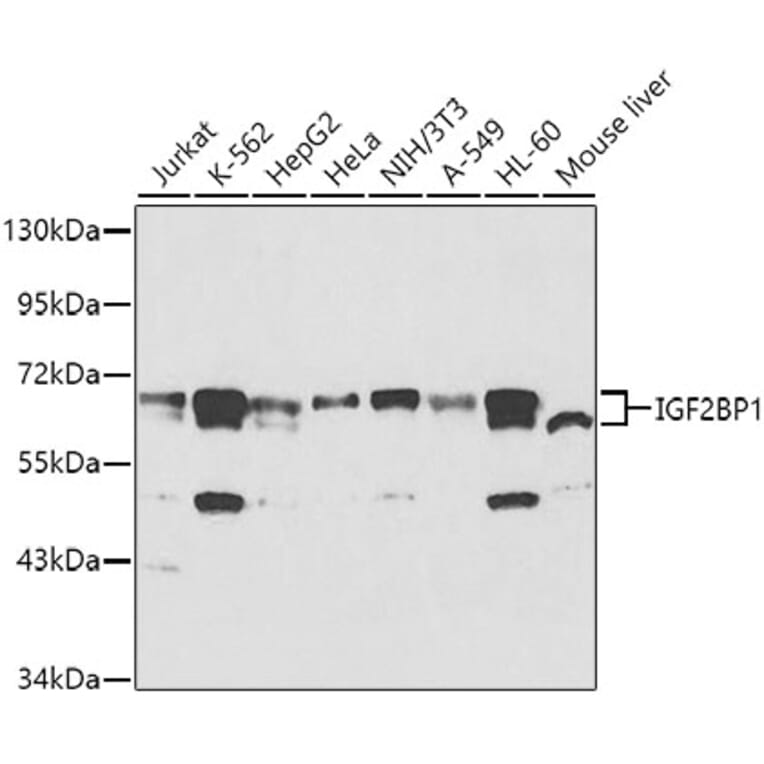 Western Blot - Anti-IGF2BP1/IMP1 Antibody (A91006) - Antibodies.com