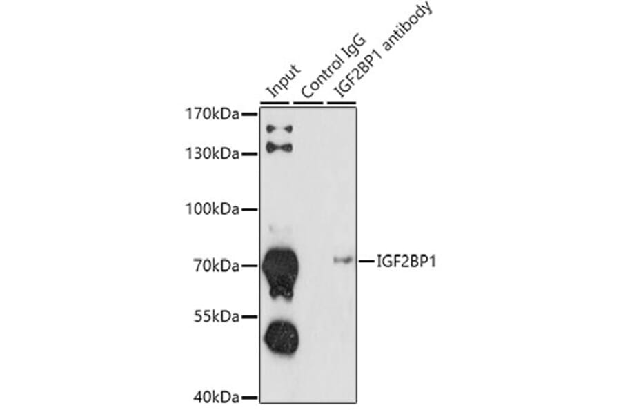 Western Blot - Anti-IGF2BP1/IMP1 Antibody (A91006) - Antibodies.com