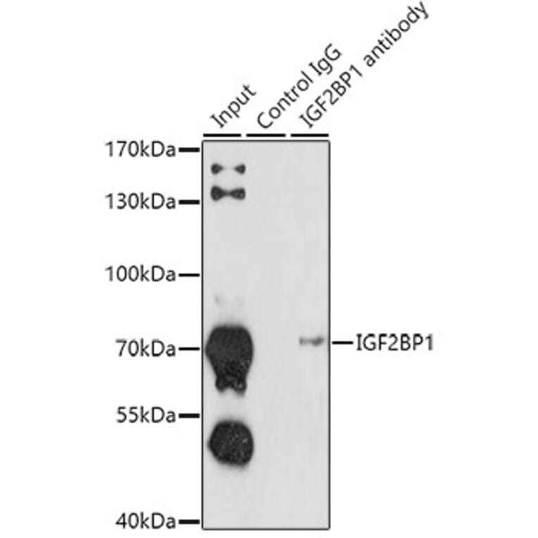 Western Blot - Anti-IGF2BP1/IMP1 Antibody (A91006) - Antibodies.com
