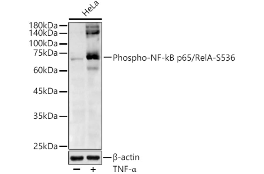 Western Blot - Anti-NF-kB p65 (phospho Ser536) Antibody (A91007) - Antibodies.com