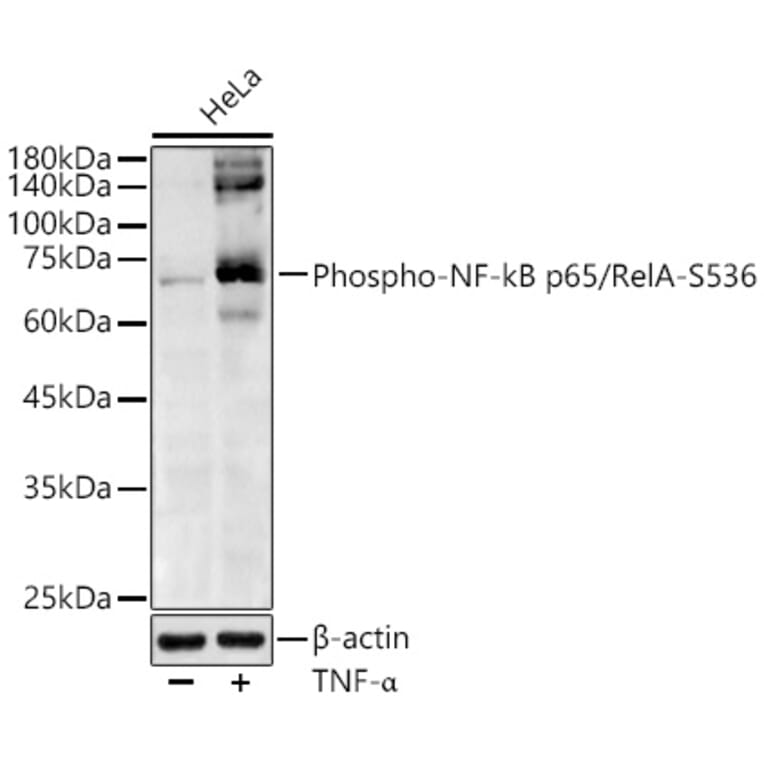 Western Blot - Anti-NF-kB p65 (phospho Ser536) Antibody (A91007) - Antibodies.com