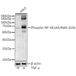 Western Blot - Anti-NF-kB p65 (phospho Ser536) Antibody (A91007) - Antibodies.com