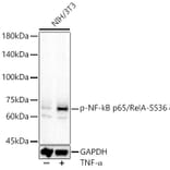 Western Blot - Anti-NF-kB p65 (phospho Ser536) Antibody (A91007) - Antibodies.com