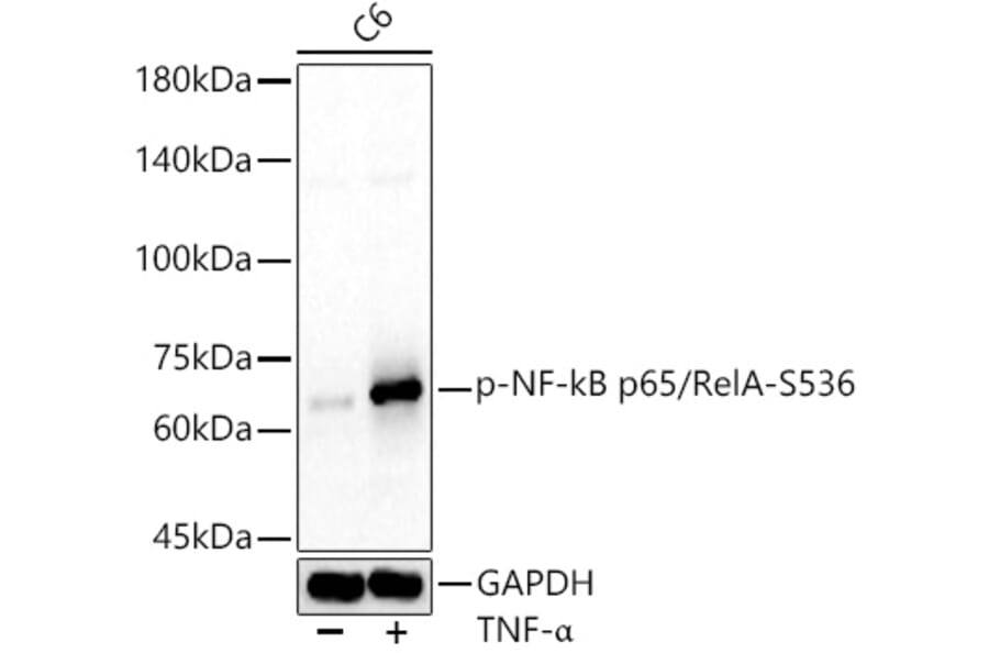 Western Blot - Anti-NF-kB p65 (phospho Ser536) Antibody (A91007) - Antibodies.com