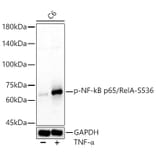 Western Blot - Anti-NF-kB p65 (phospho Ser536) Antibody (A91007) - Antibodies.com